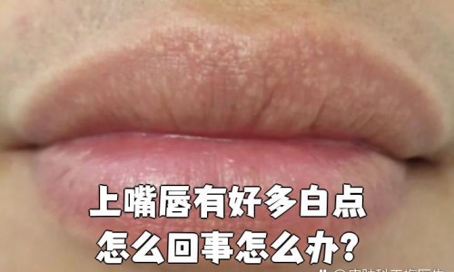 怀孕期间可以吃银耳吗有影响吗-怀孕期间可以吃银耳吗网- 孕期可以吃银耳汤吗知识,分享孕期可以吃银耳羹吗